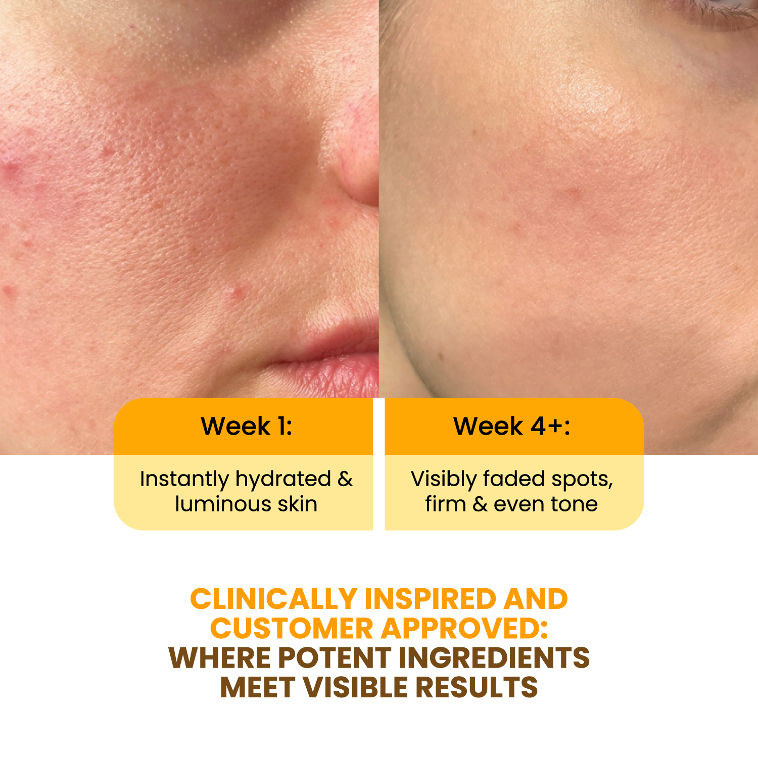 Vitamin C Serum lifestyle shot — glowing skin and daily routine